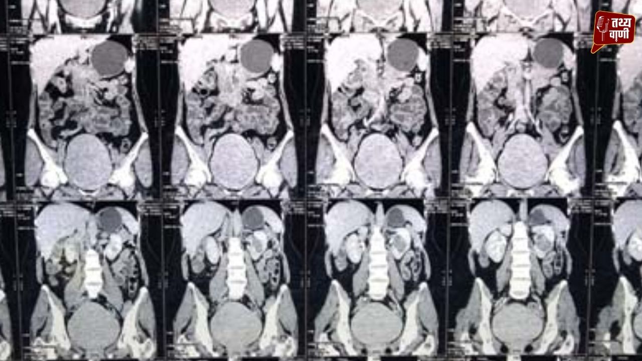 बिना चीर-फाड़ कैंसर सर्जरी से जगी नई उम्मीद, ग्रेटर नोएडा को मिली आधुनिक चिकित्सा